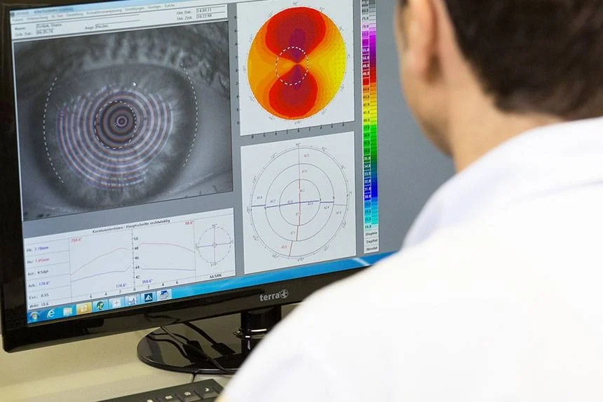 Digitale Auswertung von Augenaufnahmen am Monitor